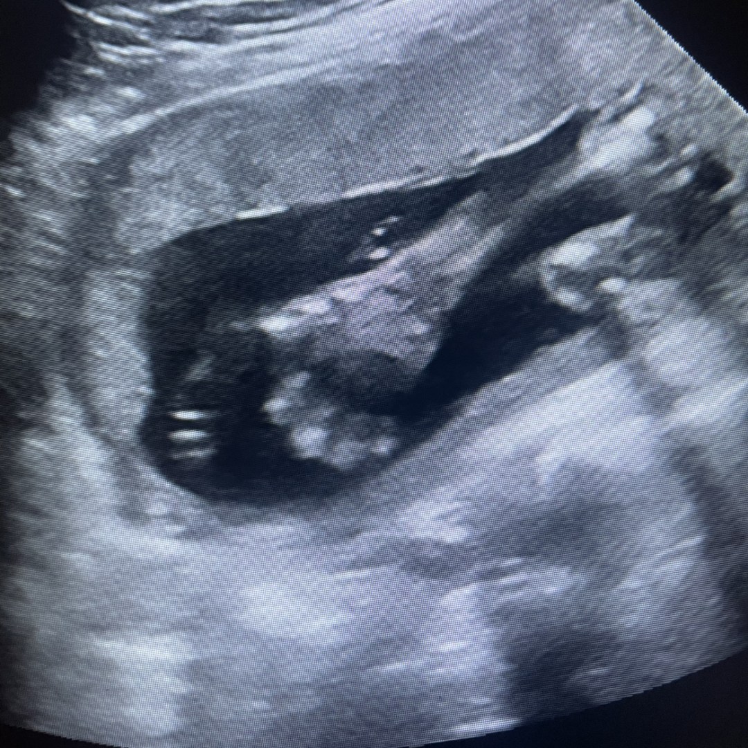 Photo shared by Corrie for their Babylist baby registry.