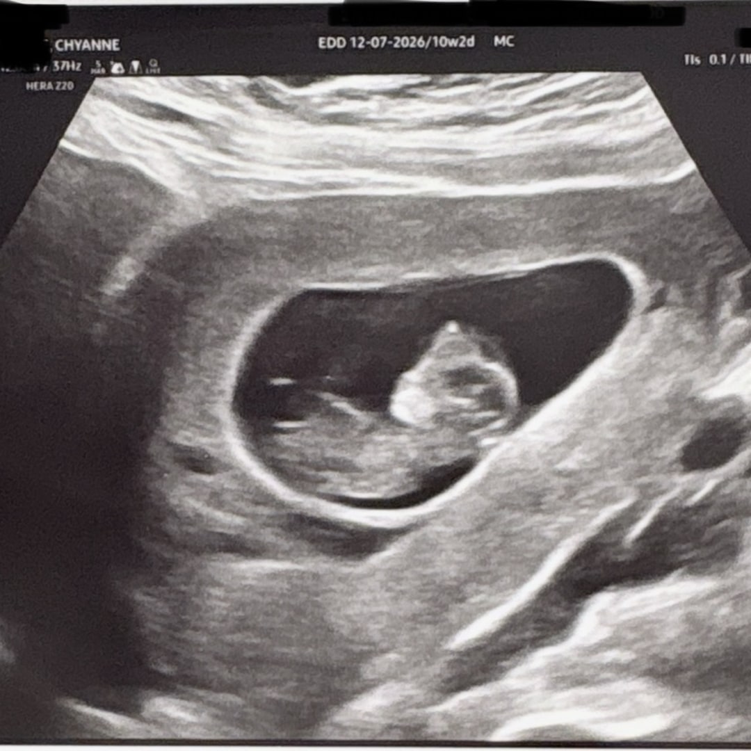 Photo shared by Chyanne for their Babylist baby registry.