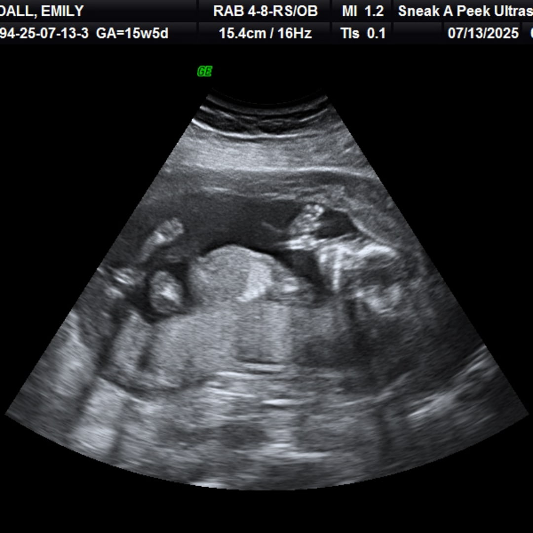 Photo shared by Emily for their Babylist baby registry.
