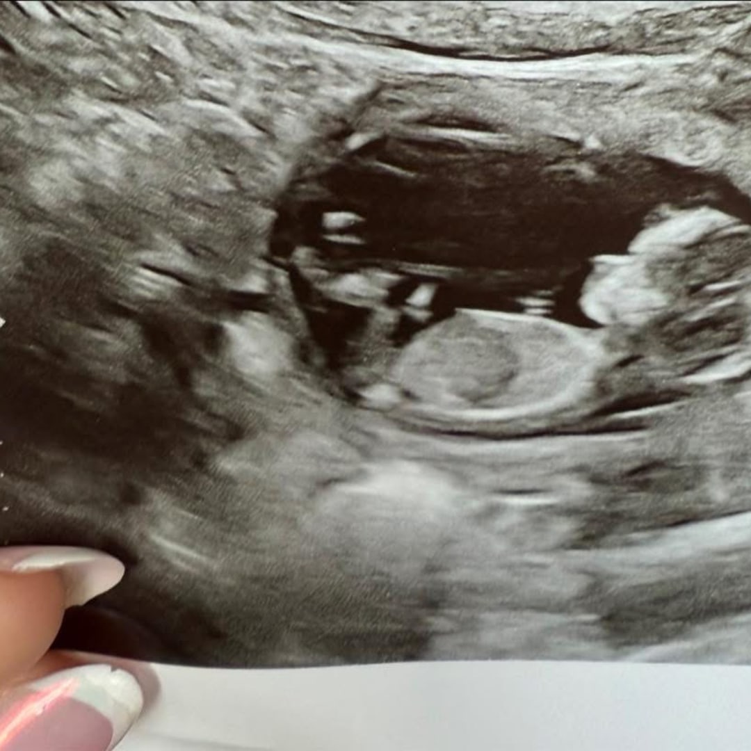Photo shared by Hannah for their Babylist baby registry.