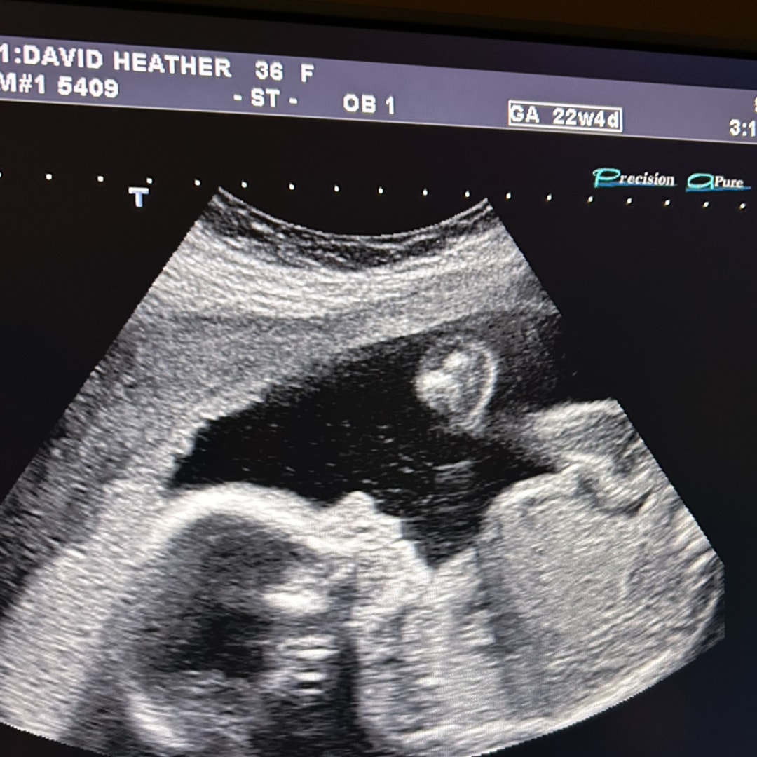 Photo shared by Heather for their Babylist baby registry.