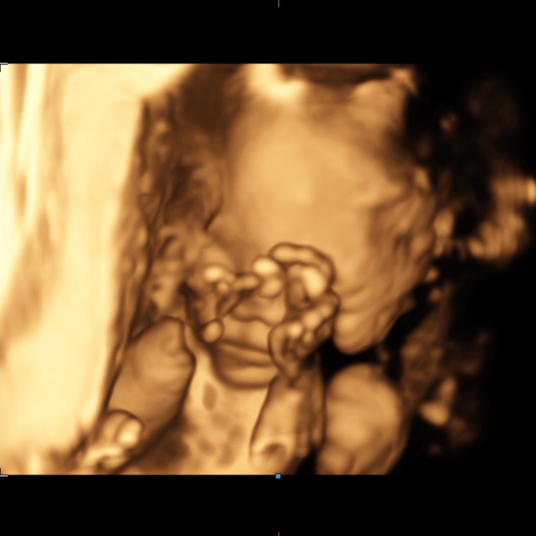 Photo shared by Courtney for their Babylist baby registry.