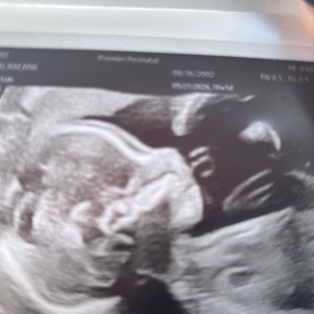 Photo shared by Raeana for their Babylist baby registry.