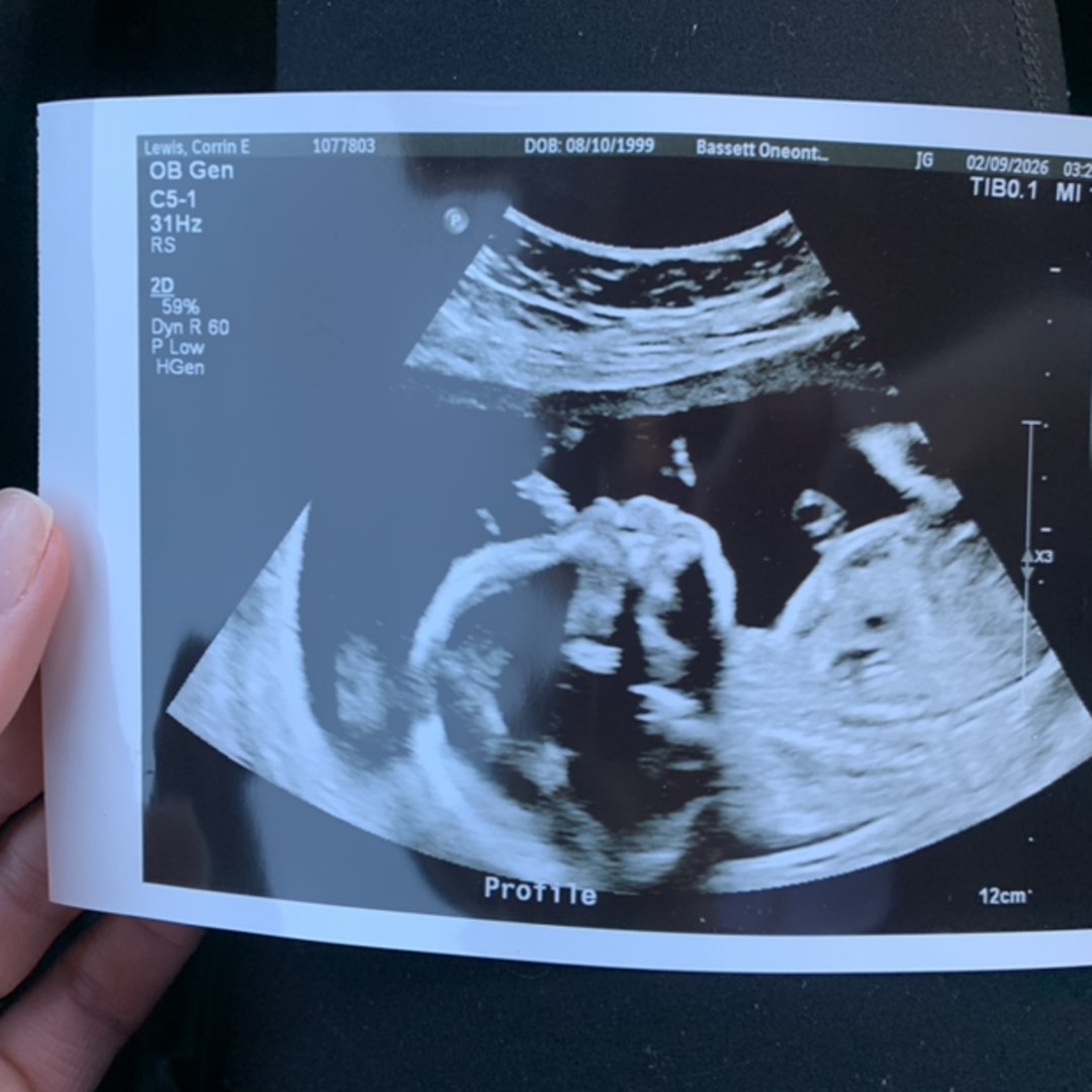 Photo shared by Corrin for their Babylist baby registry.