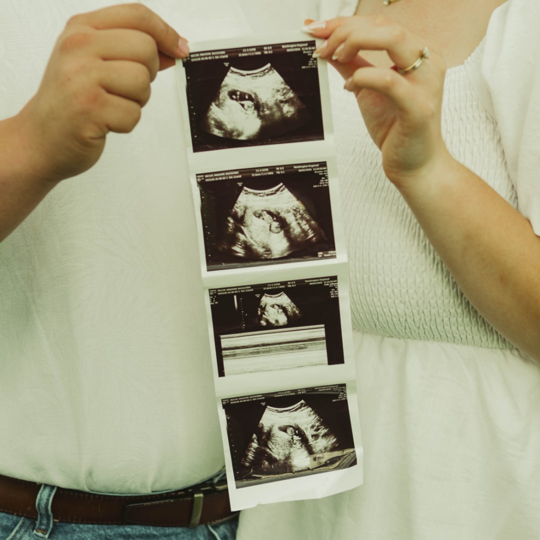 Photo shared by Maddie for their Babylist baby registry.