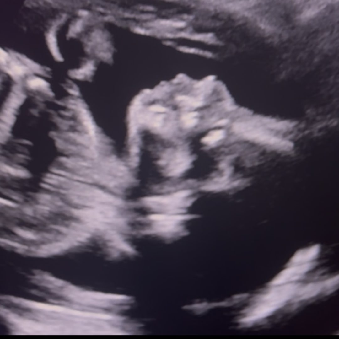Photo shared by Jeridan for their Babylist baby registry.