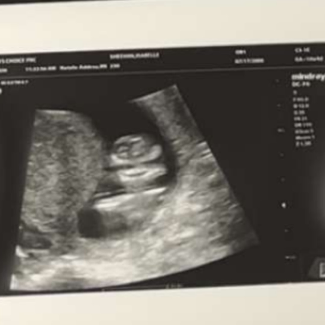 Photo shared by Isabelle for their Babylist baby registry.