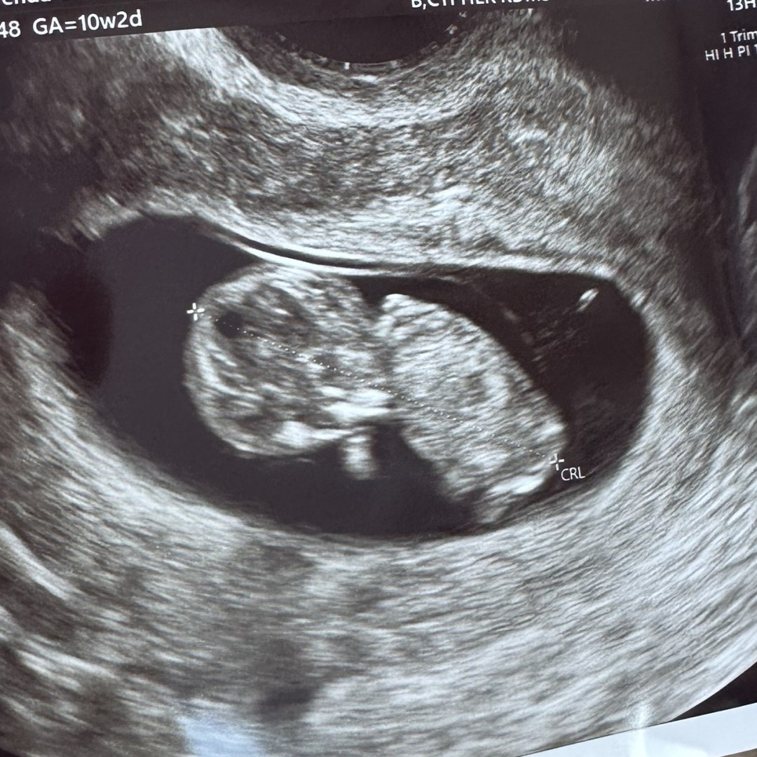 Photo shared by Christy for their Babylist baby registry.