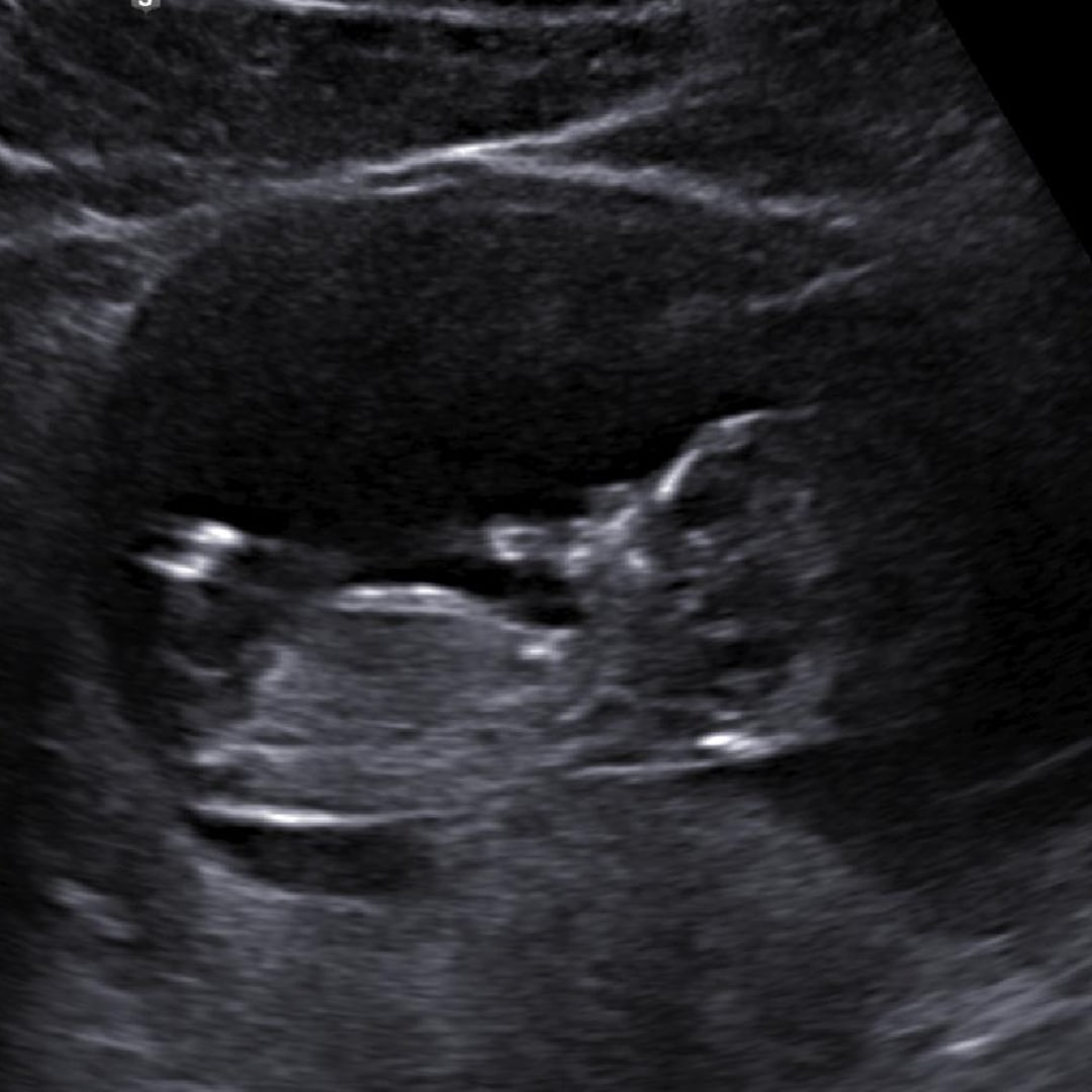 Photo shared by Jocelyn for their Babylist baby registry.