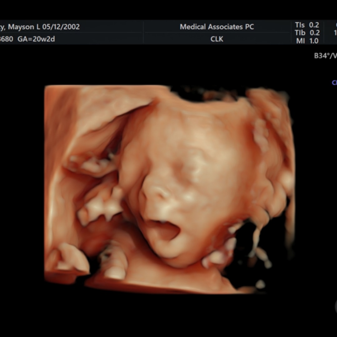 Photo shared by Mayson for their Babylist baby registry.