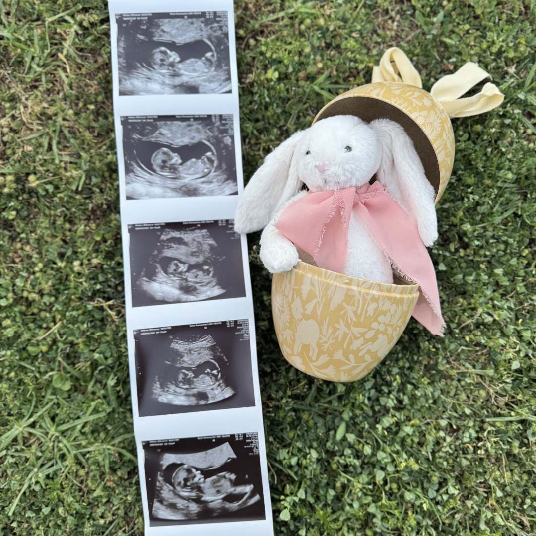 Photo shared by Wilmarose for their Babylist baby registry.