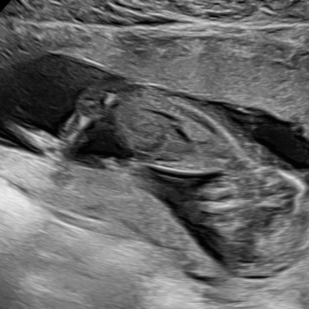 Photo shared by Jenna for their Babylist baby registry.