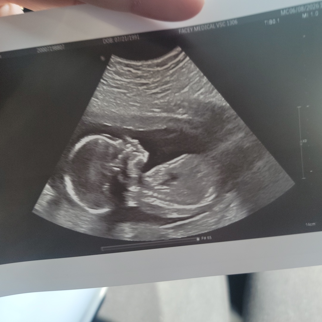 Photo shared by Jessica for their Babylist baby registry.