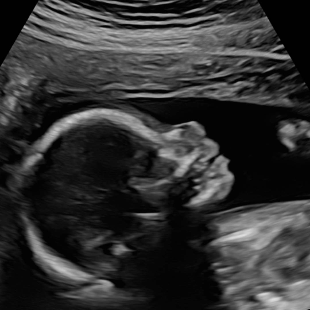 Photo shared by Camille for their Babylist baby registry.