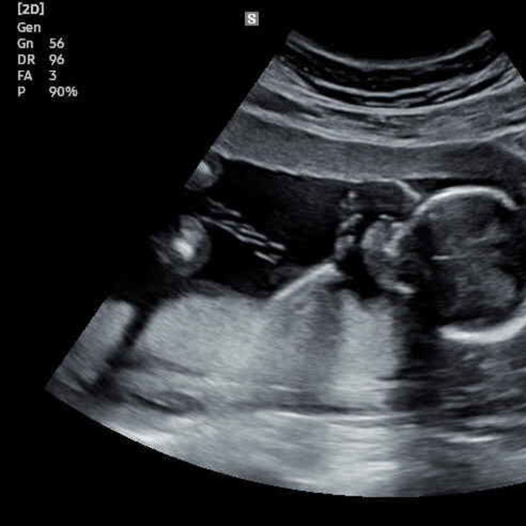 Photo shared by Dani for their Babylist baby registry.