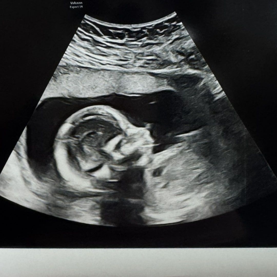 Photo shared by Maggie for their Babylist baby registry.