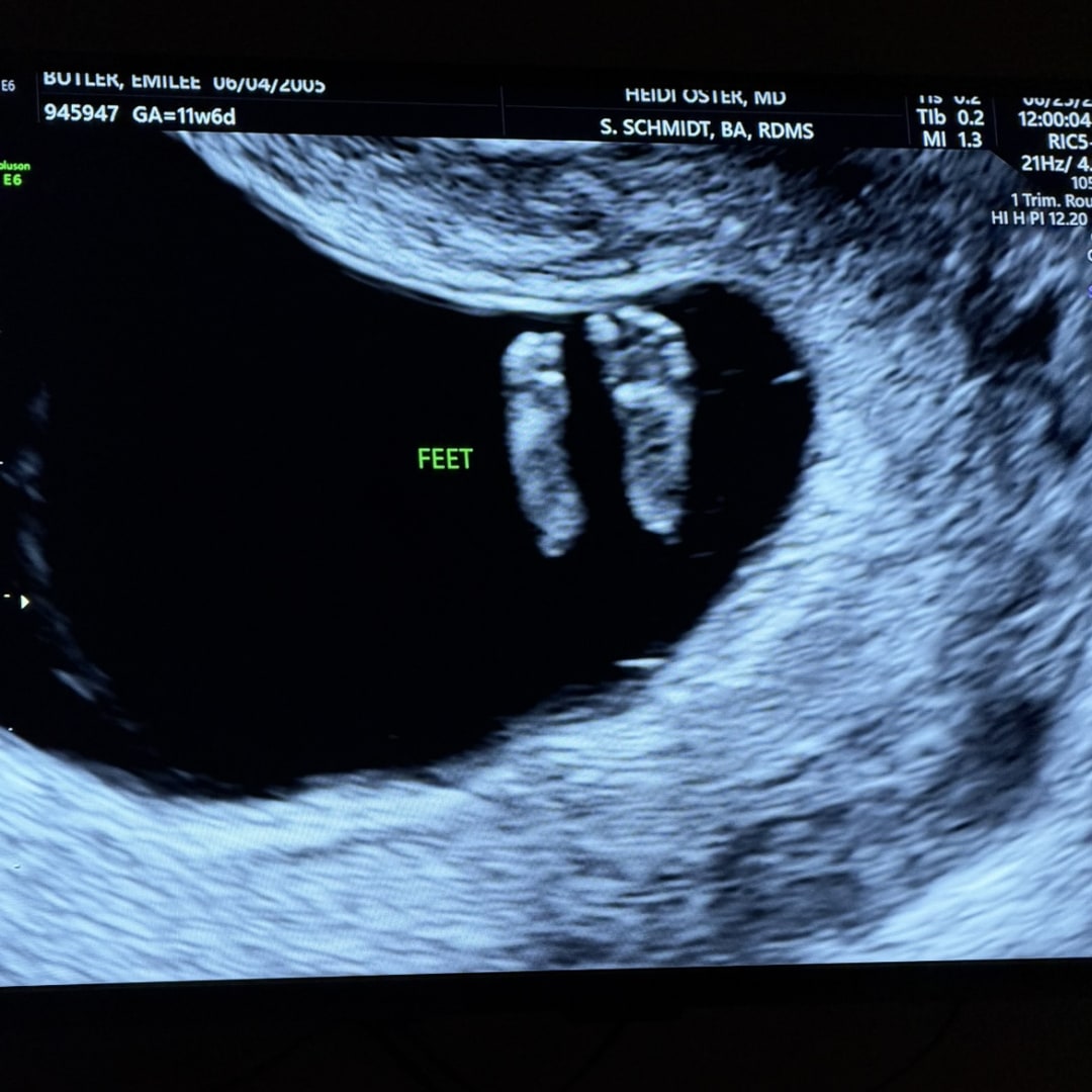 Photo shared by Emilee for their Babylist baby registry.