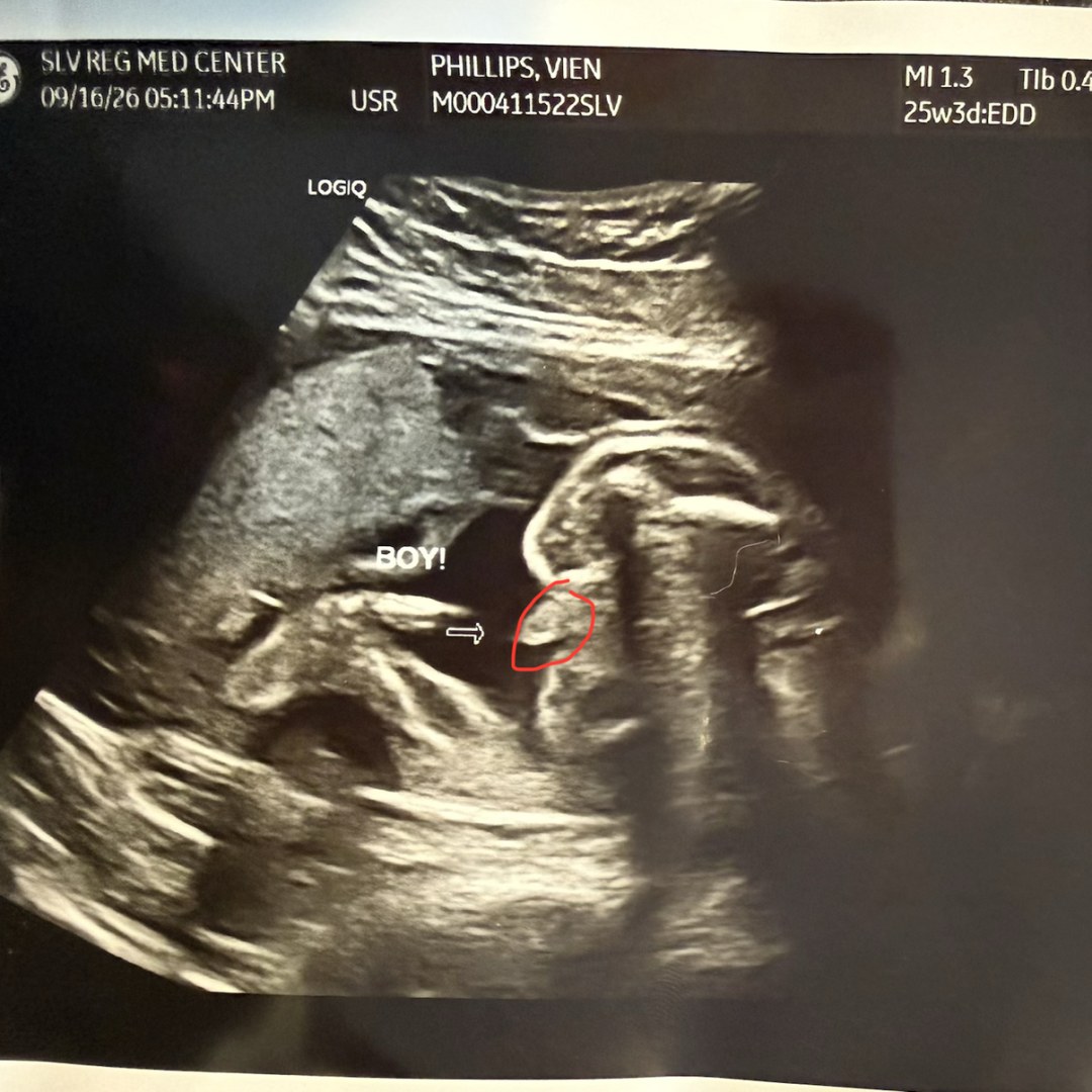 Photo shared by Athena for their Babylist baby registry.