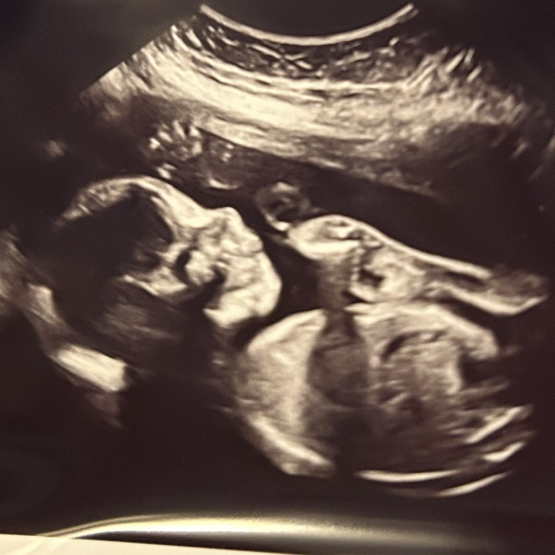 Photo shared by Cynthia for their Babylist baby registry.