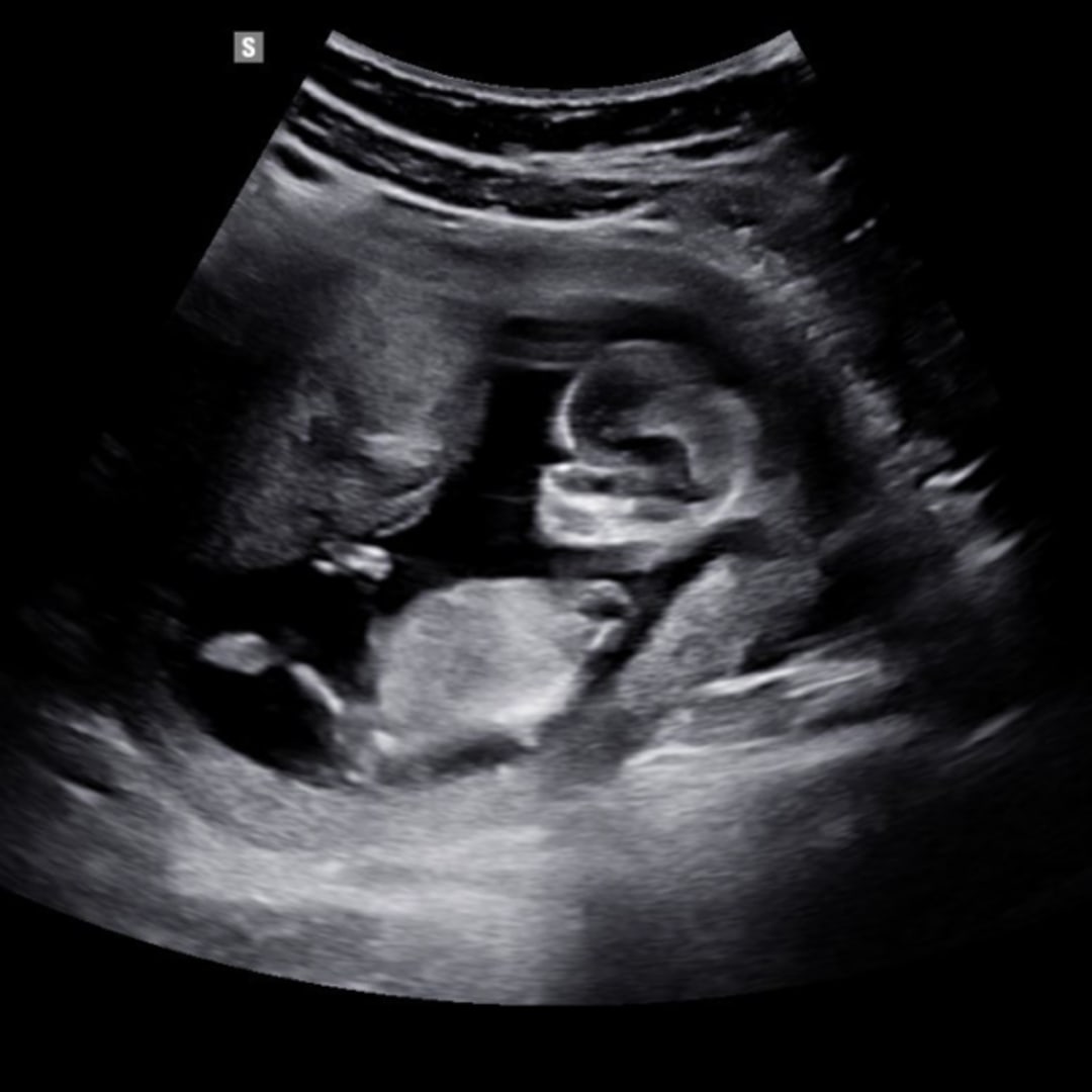 Photo shared by Caylen for their Babylist baby registry.