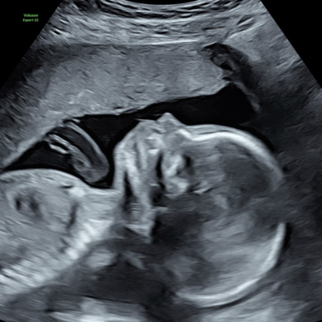 Photo shared by Hailey for their Babylist baby registry.