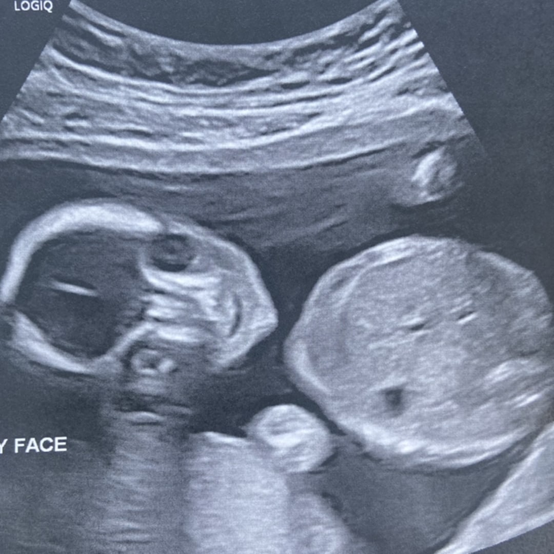 Photo shared by Leslie for their Babylist baby registry.