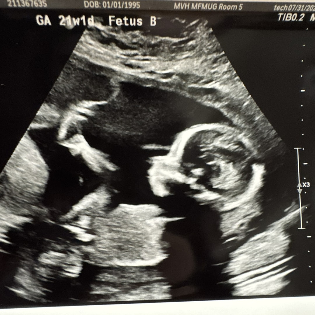 Photo shared by Angelica for their Babylist baby registry.