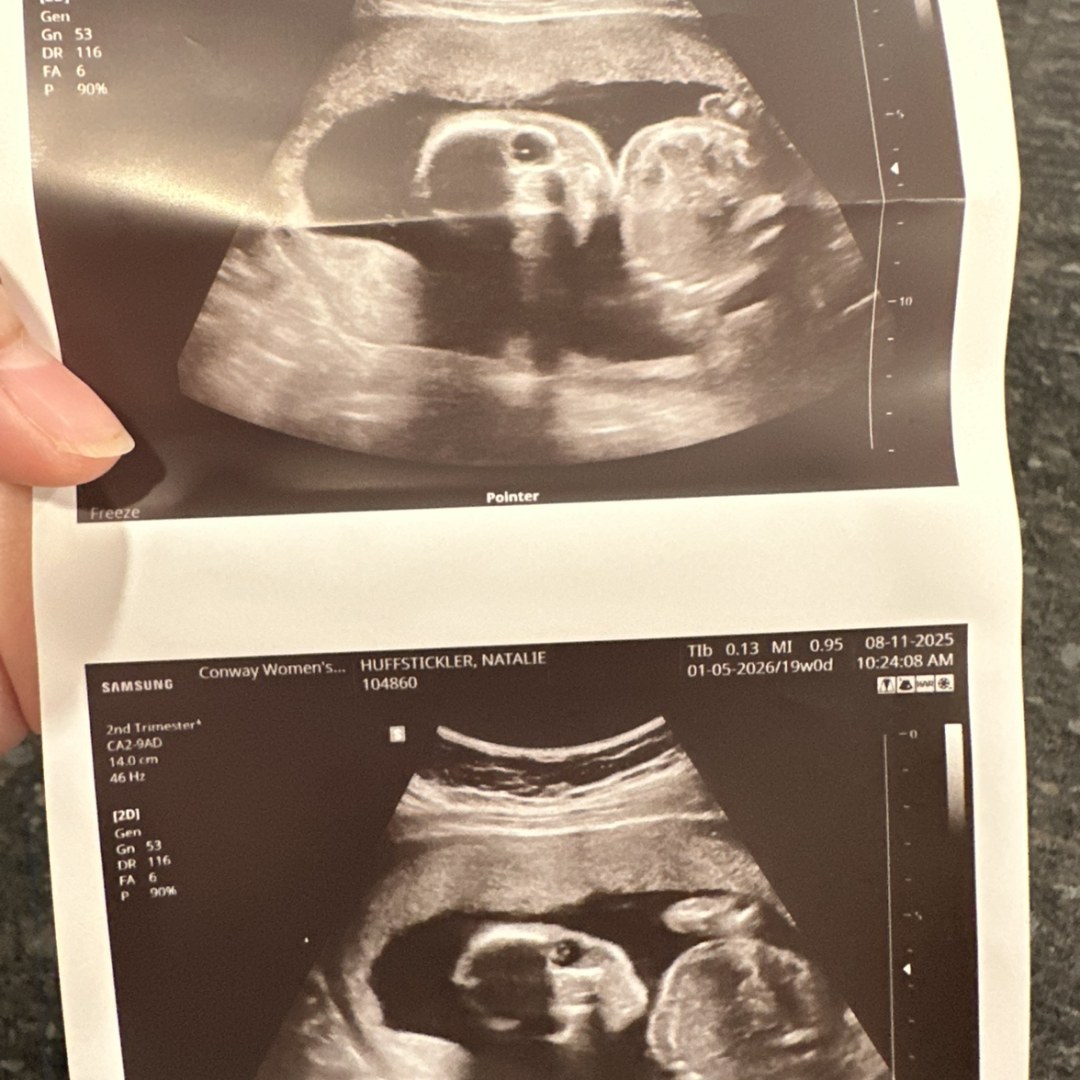 Photo shared by Natalie for their Babylist baby registry.