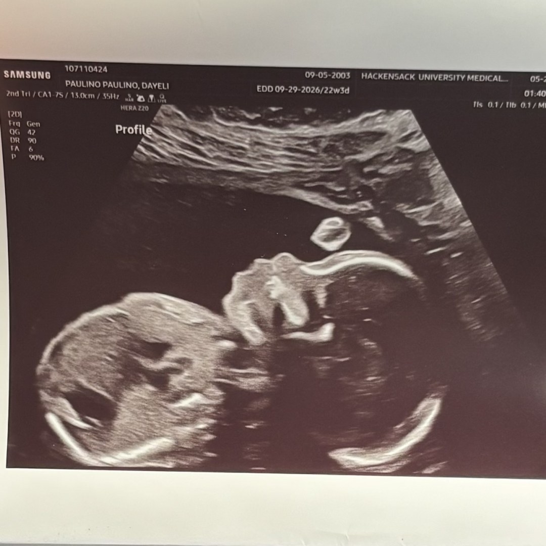Photo shared by Dayeli for their Babylist baby registry.