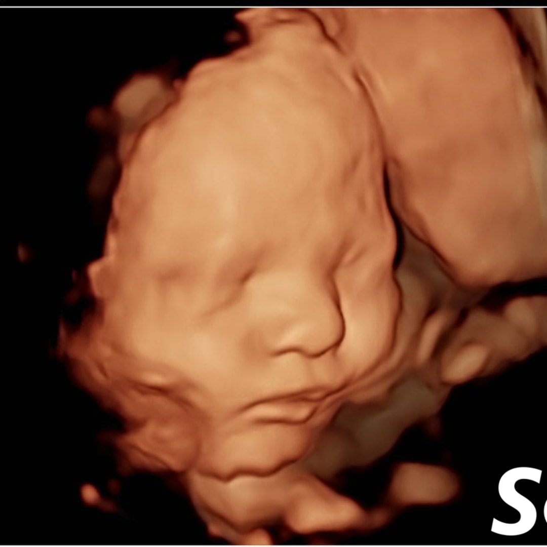 Photo shared by McKenna for their Babylist baby registry.