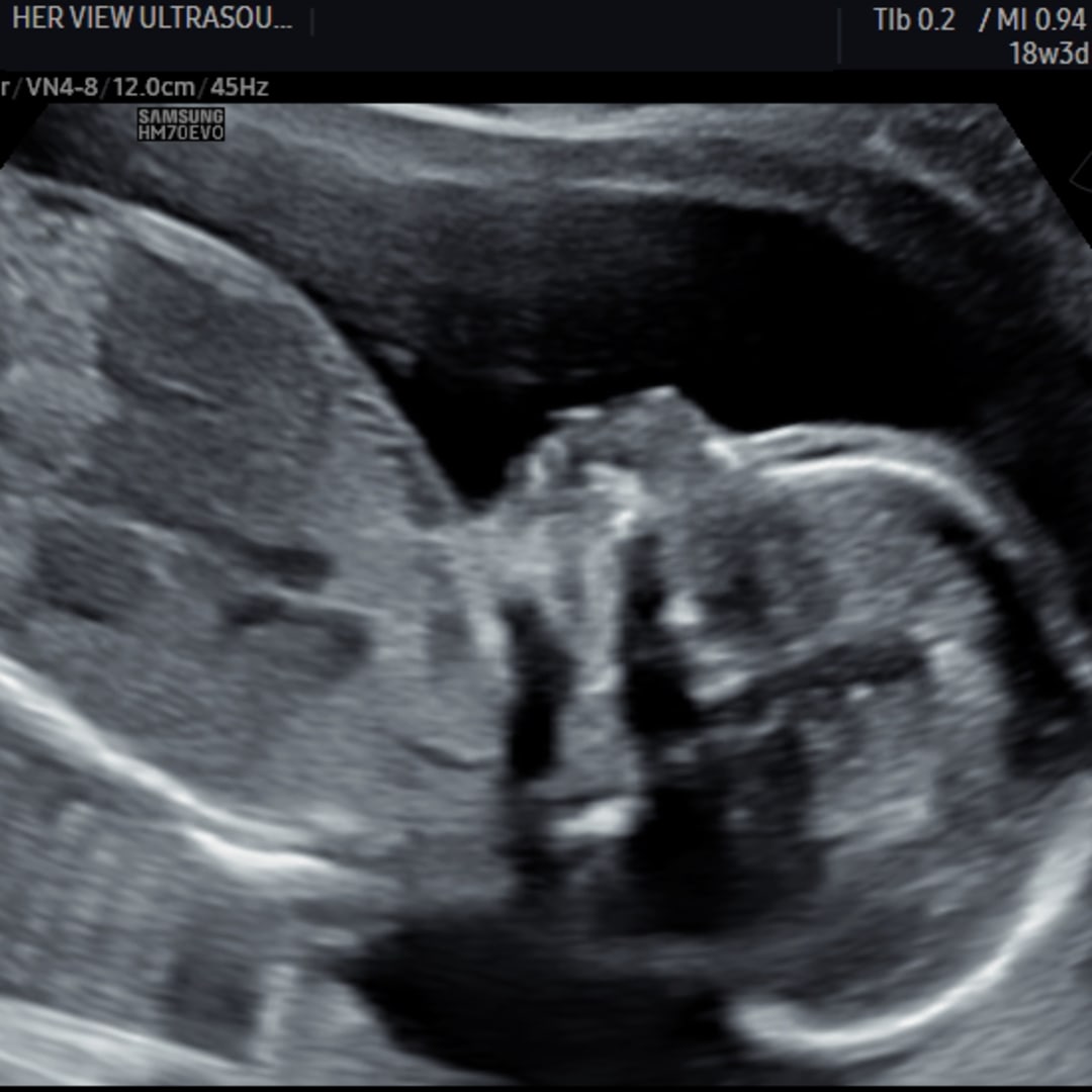 Photo shared by Melissa for their Babylist baby registry.