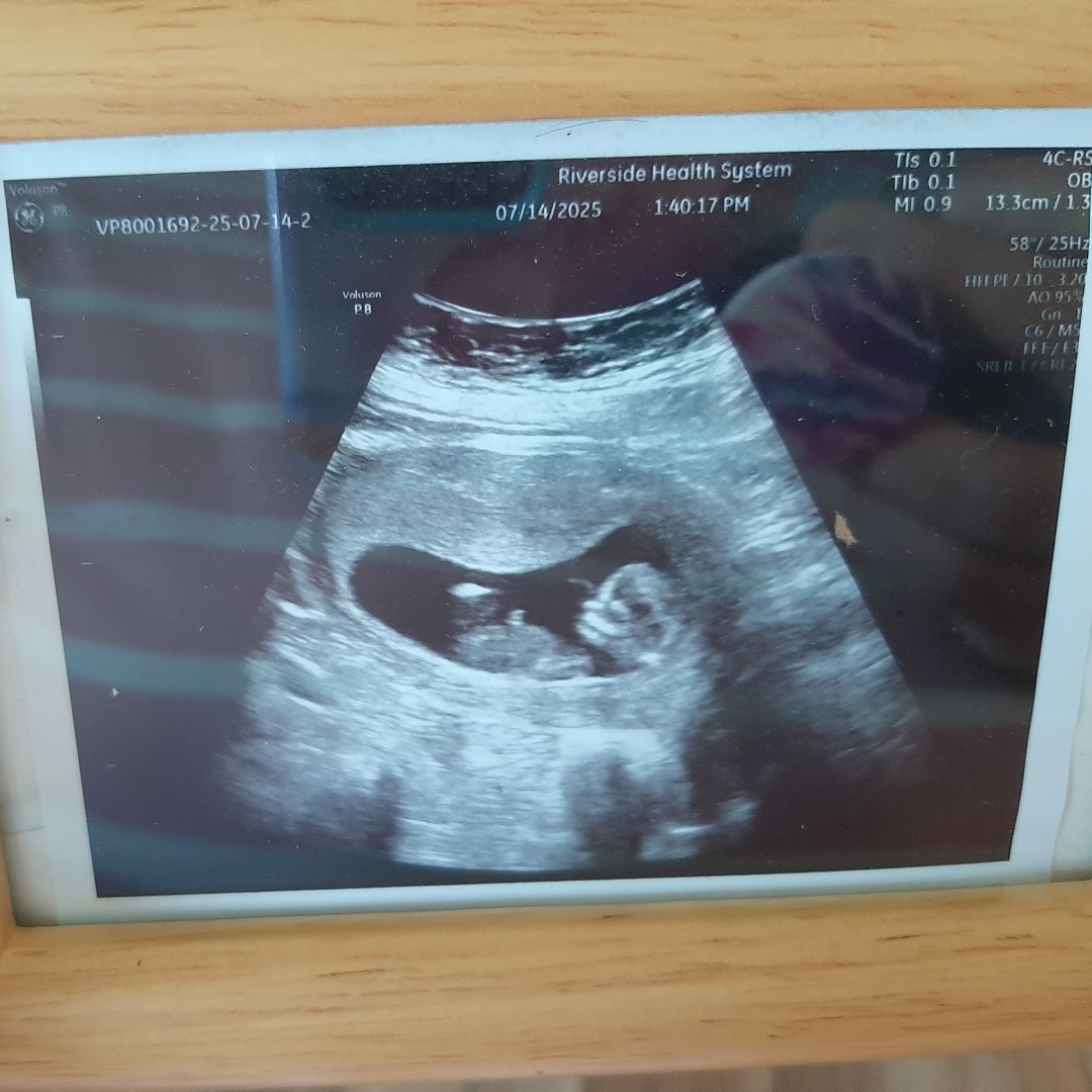 Photo shared by Rachael for their Babylist baby registry.