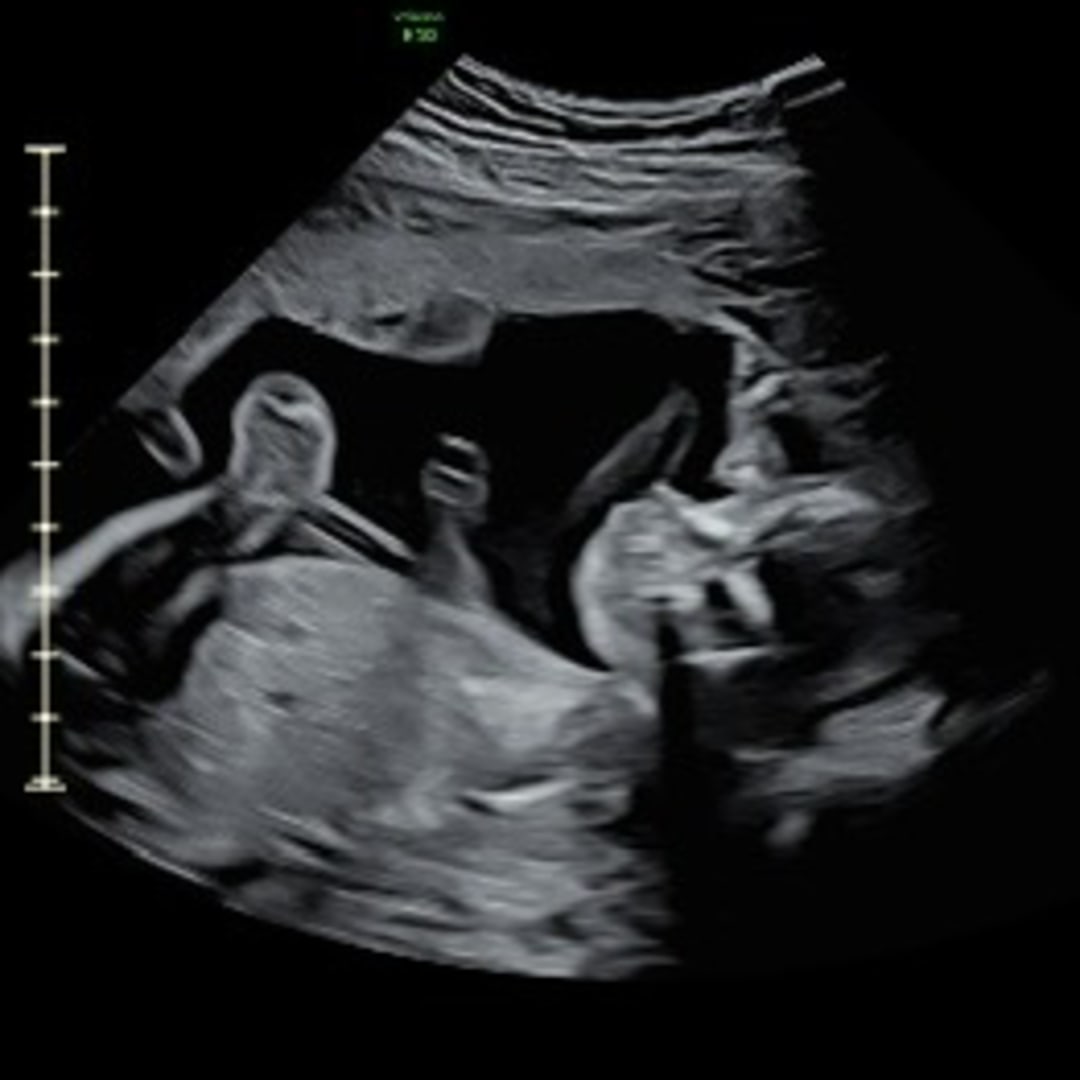 Photo shared by Jenna for their Babylist baby registry.