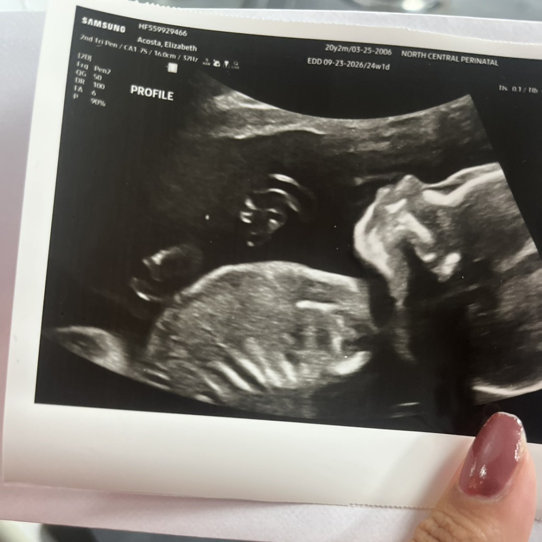 Photo shared by Elizabeth for their Babylist baby registry.