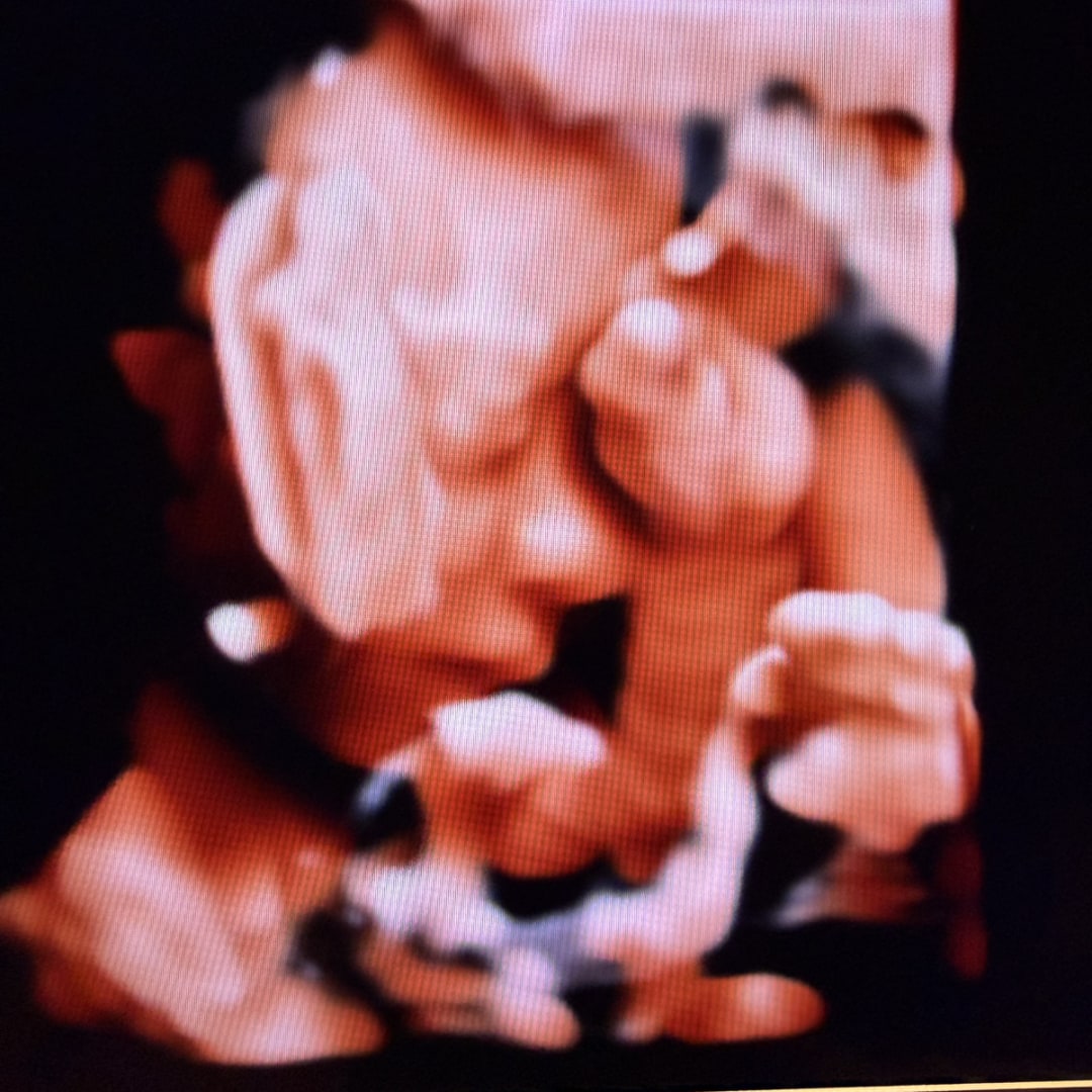 Photo shared by Gladys for their Babylist baby registry.