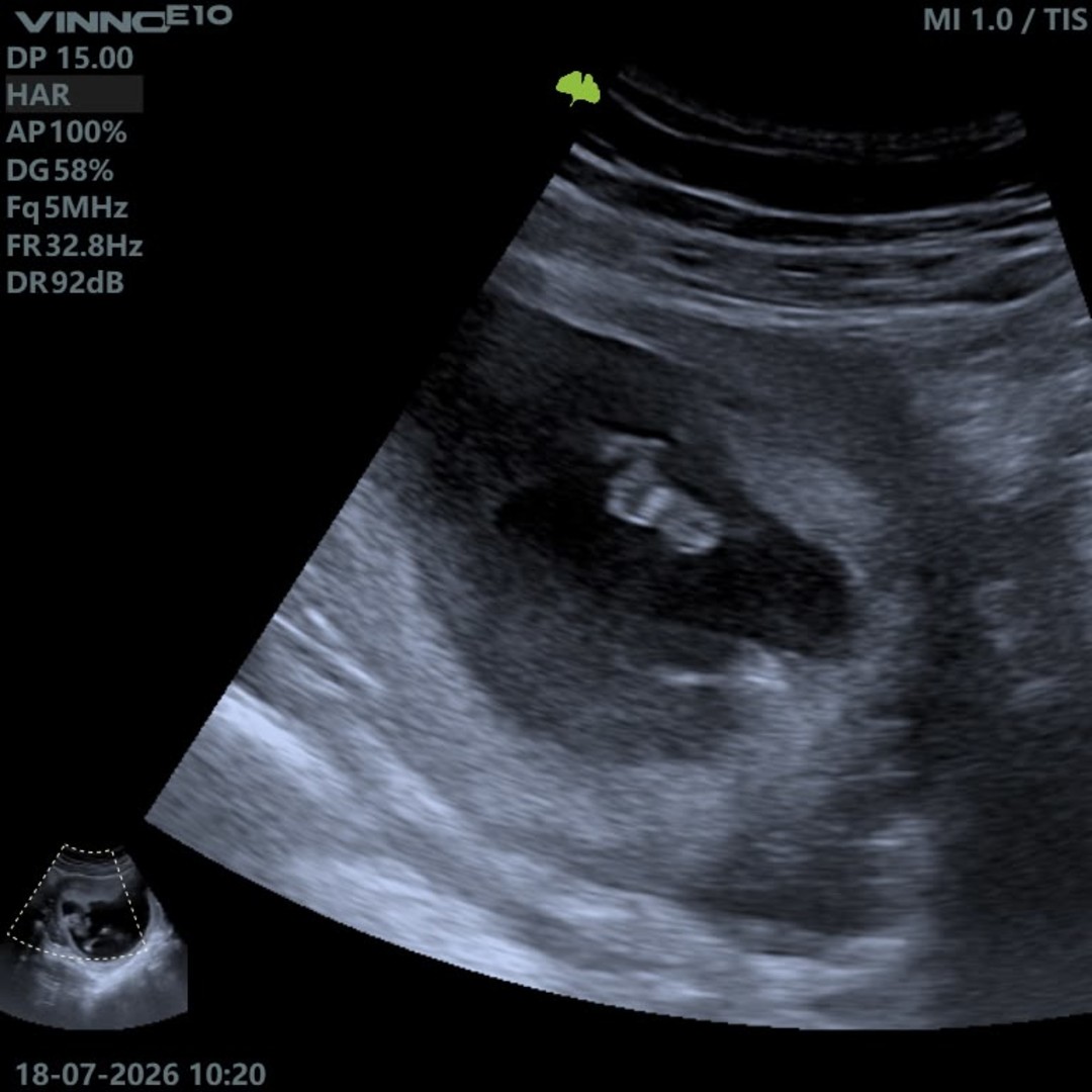 Photo shared by Danel for their Babylist baby registry.
