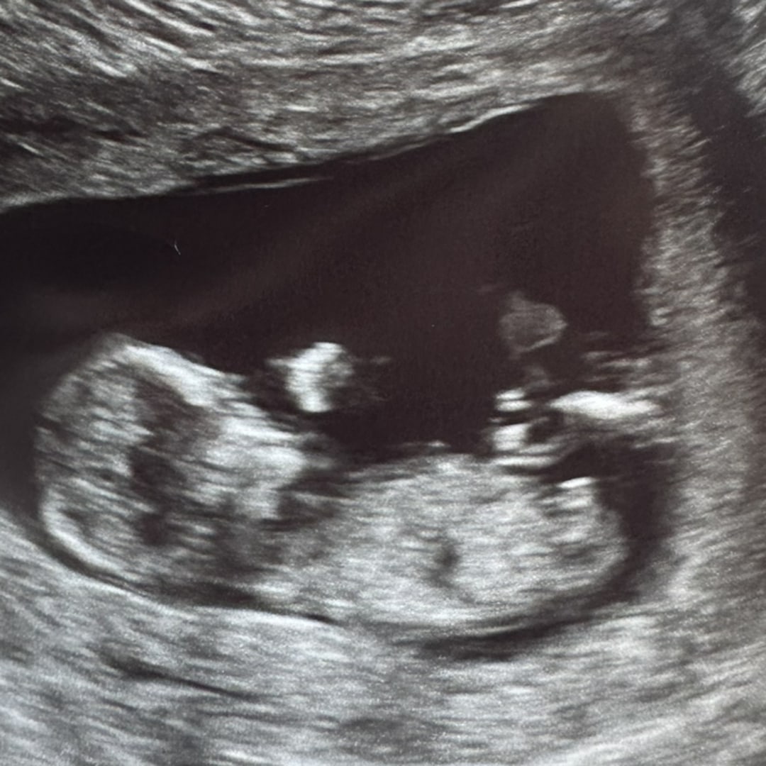 Photo shared by Joan for their Babylist baby registry.