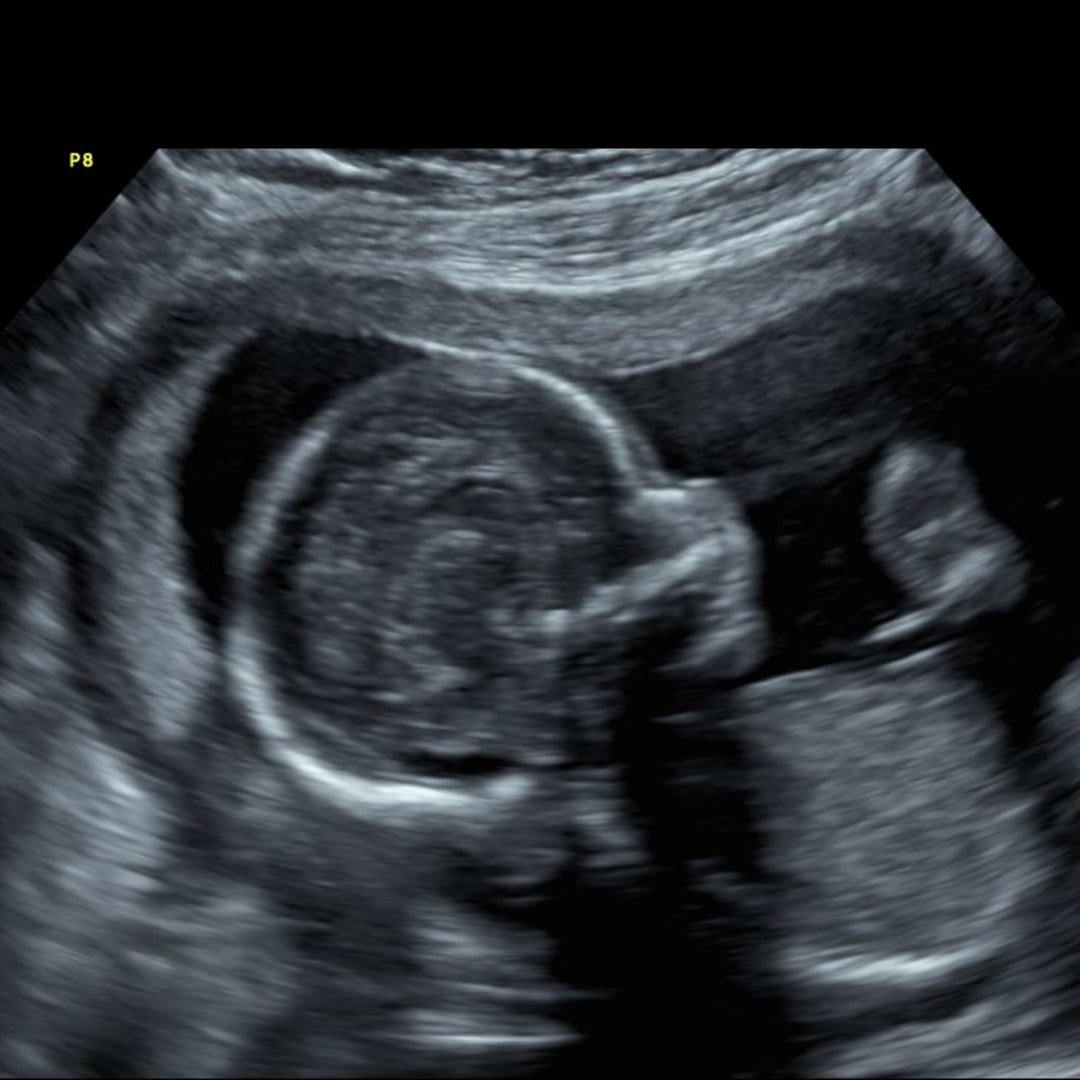 Photo shared by Dallas for their Babylist baby registry.