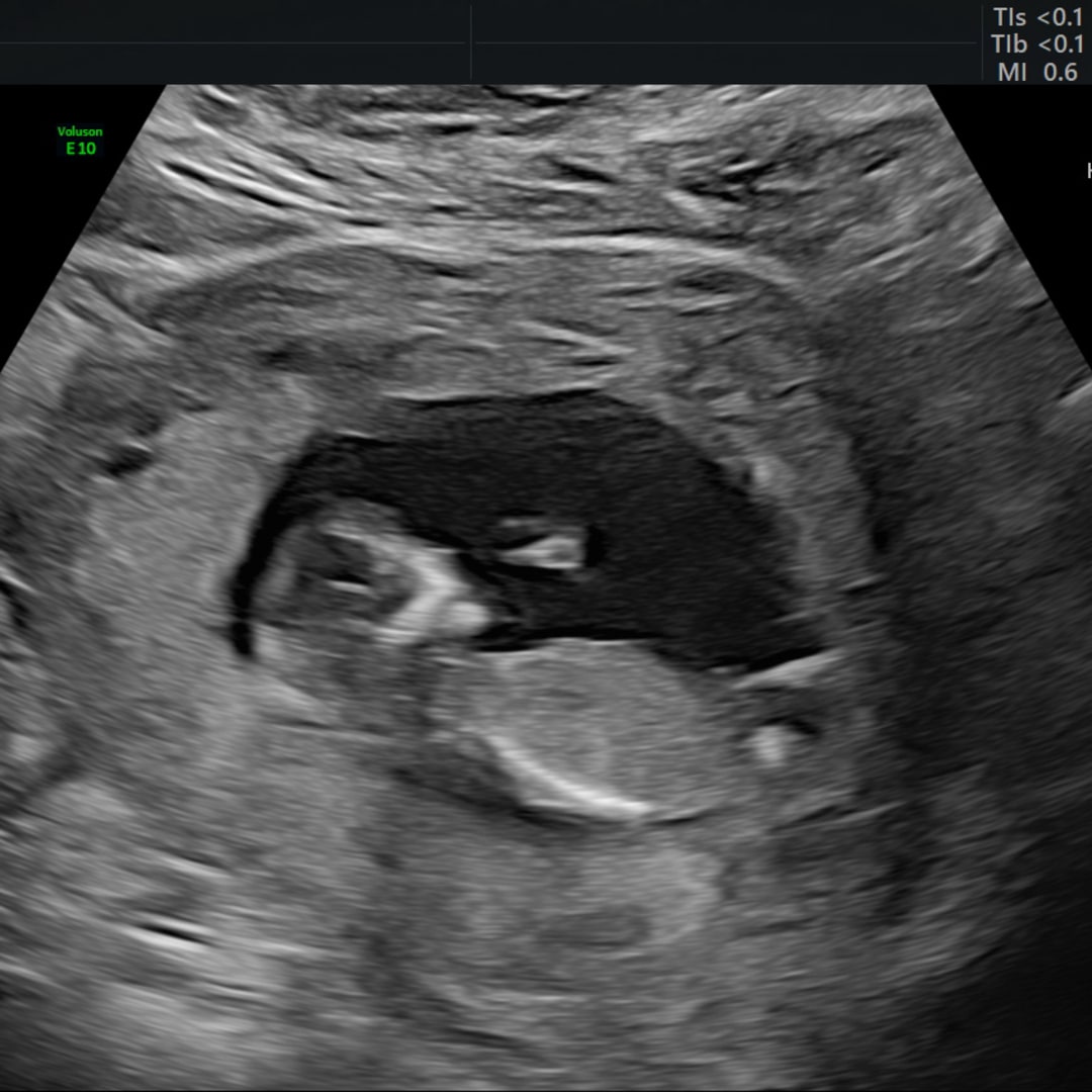 Photo shared by Hannah for their Babylist baby registry.