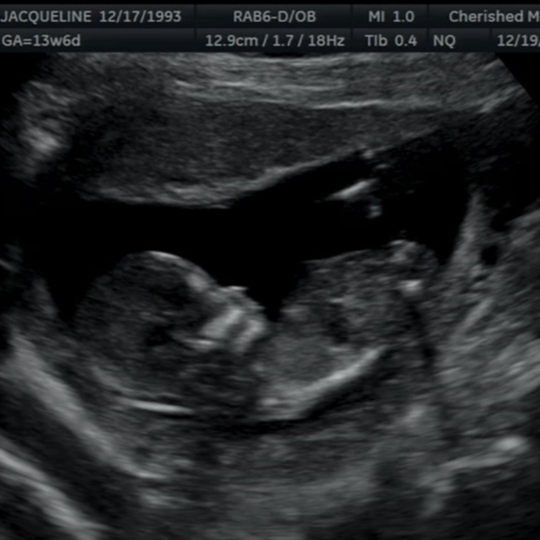 Photo shared by Jackie for their Babylist baby registry.