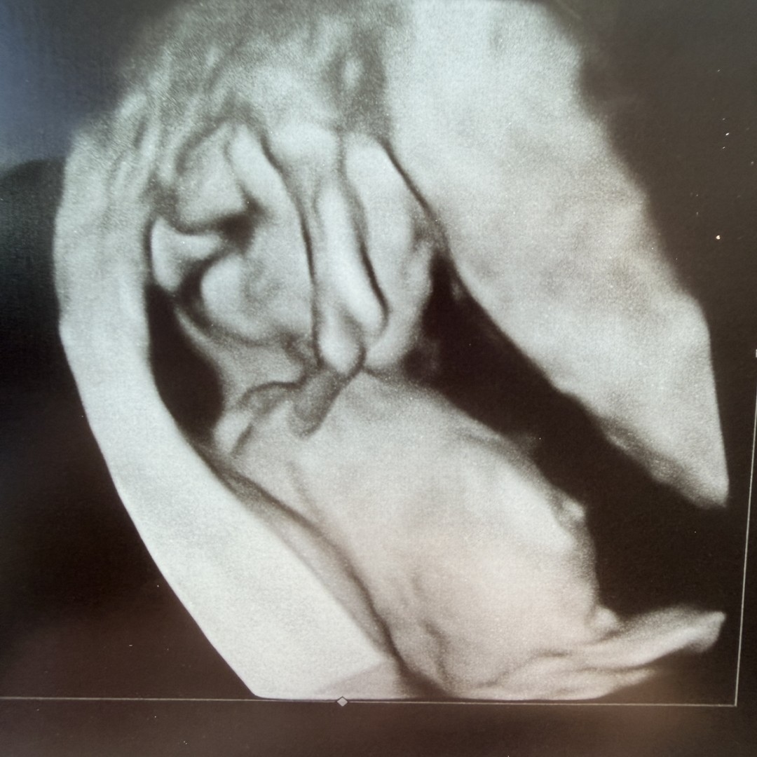 Photo shared by Joy for their Babylist baby registry.
