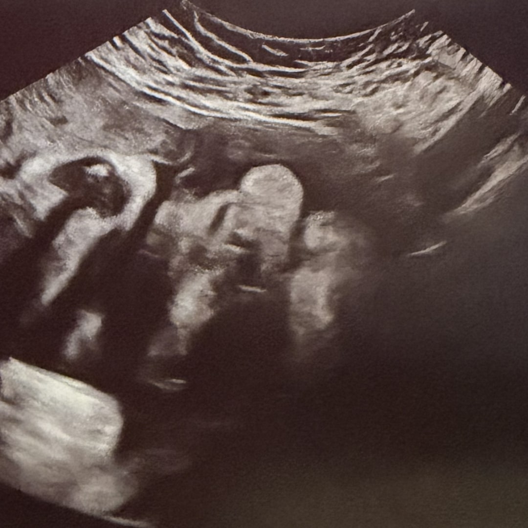 Photo shared by Kasandra for their Babylist baby registry.