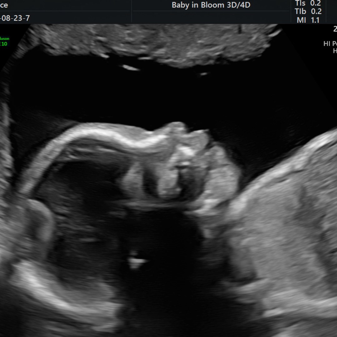Photo shared by Grace for their Babylist baby registry.
