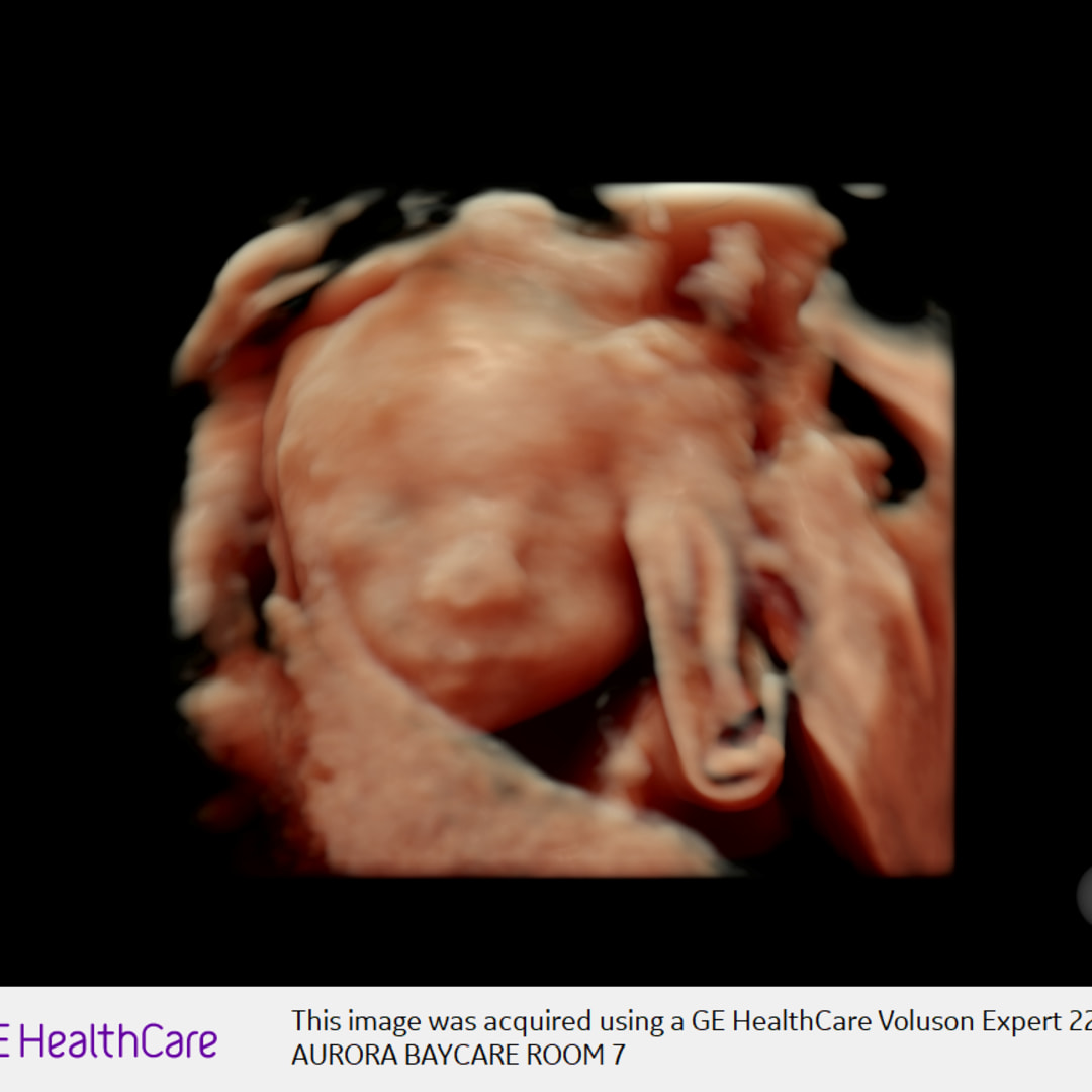 Photo shared by Olivia for their Babylist baby registry.