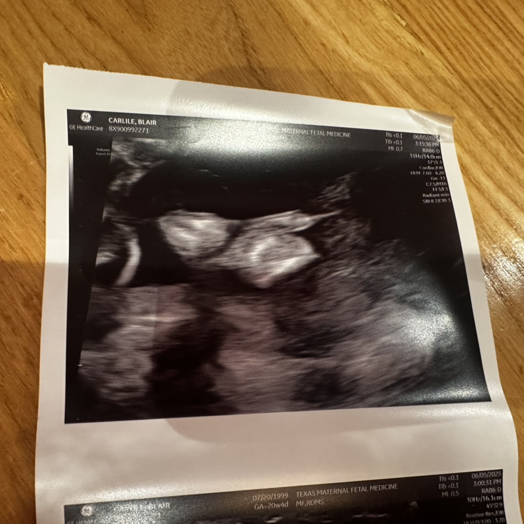 Photo shared by Blair for their Babylist baby registry.