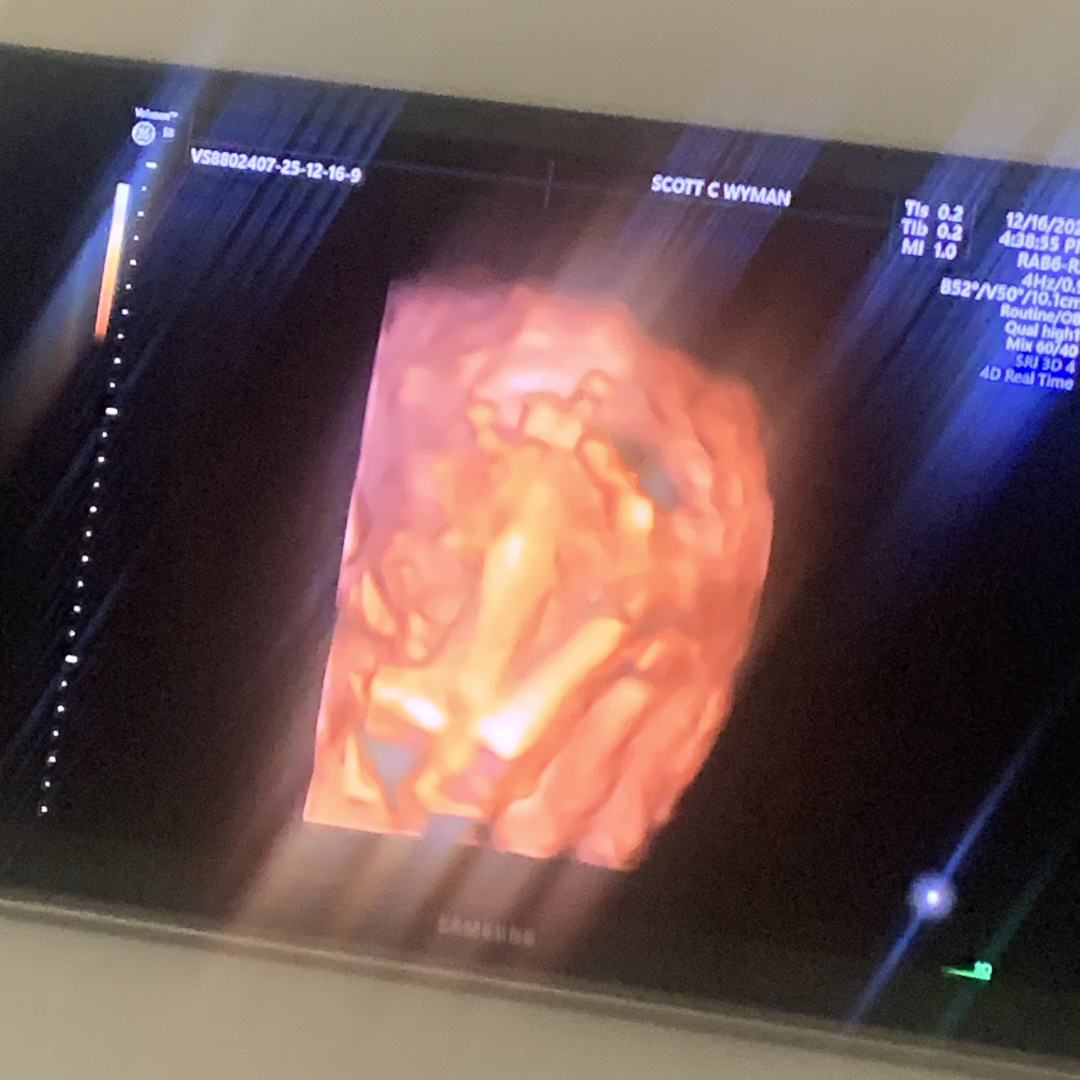 Photo shared by Destiny for their Babylist baby registry.