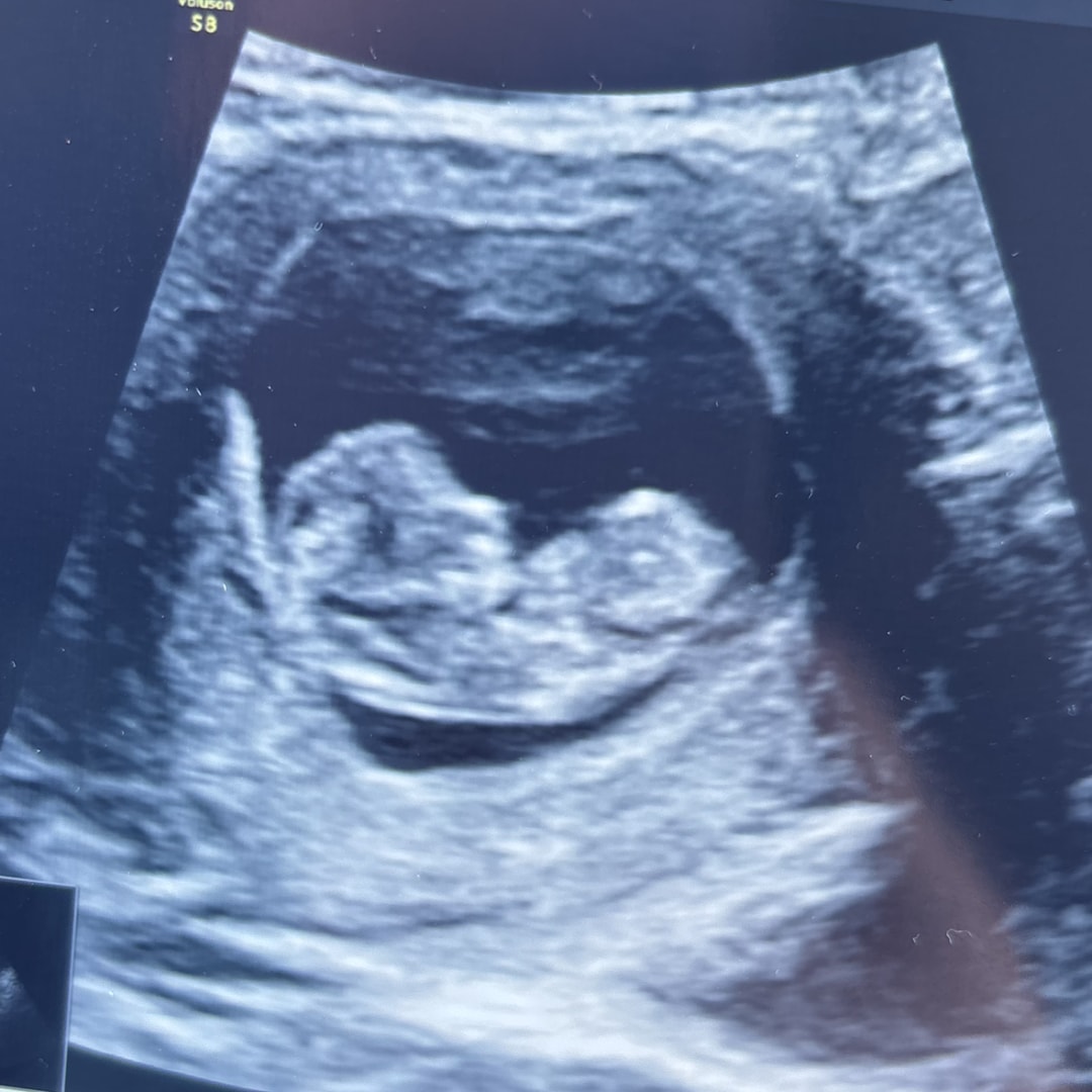 Photo shared by Cheyanne for their Babylist baby registry.