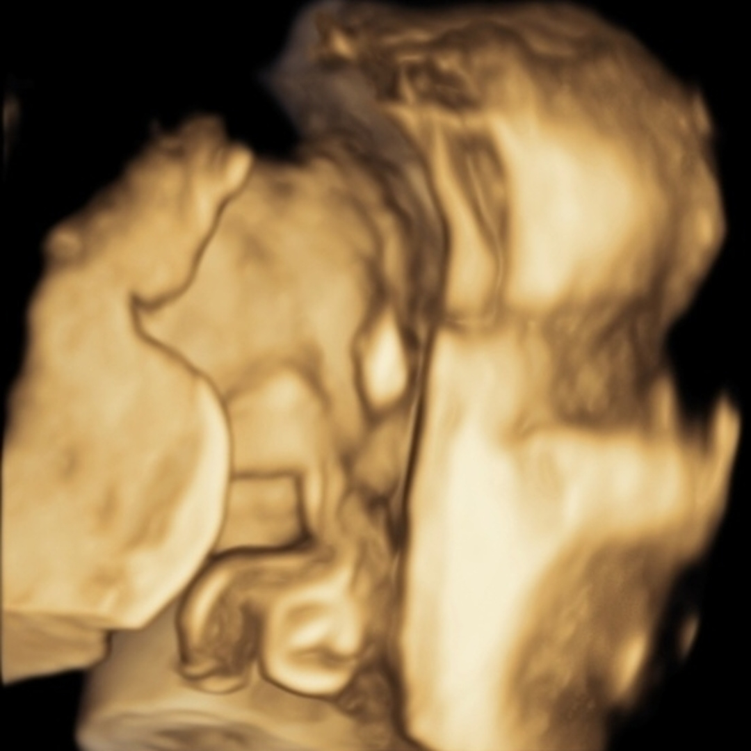 Photo shared by McKinley for their Babylist baby registry.