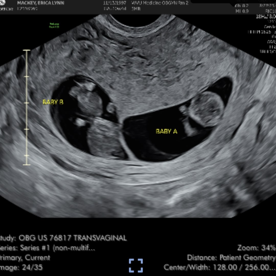 Photo shared by Erica for their Babylist baby registry.