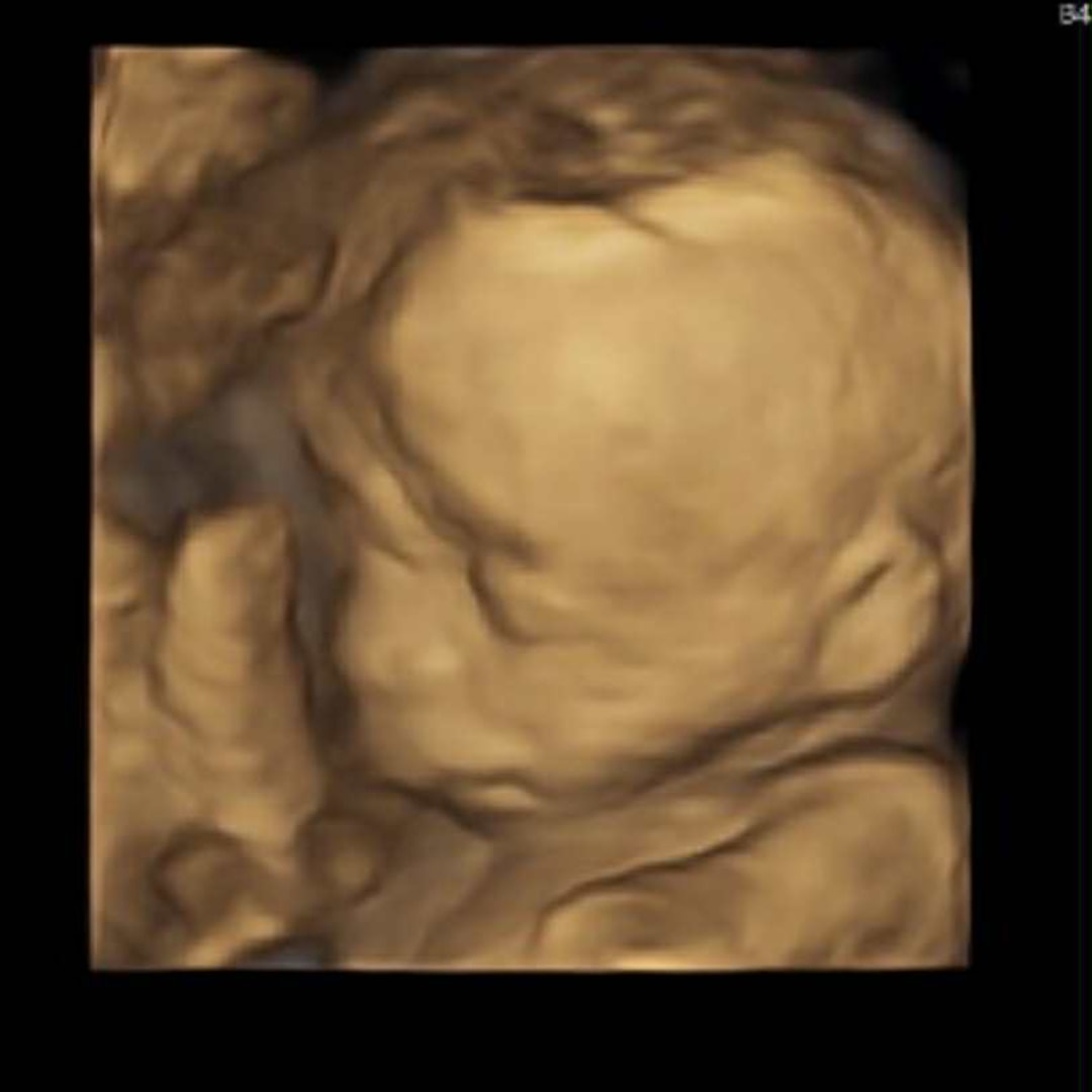 Photo shared by Aracelis for their Babylist baby registry.